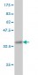 DHX9 Antibody (monoclonal) (M01)